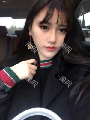 線D隆鼻恢復(fù)過(guò)程圖片，真實(shí)案例照片