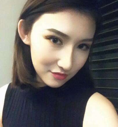 隆鼻失敗修復(fù)后恢復(fù)圖分享，鼻子修復(fù)價(jià)格9800元