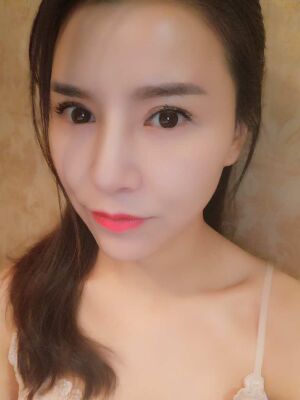 臉部埋埋蛋白線.提升果圖，真實(shí)經(jīng)歷分享