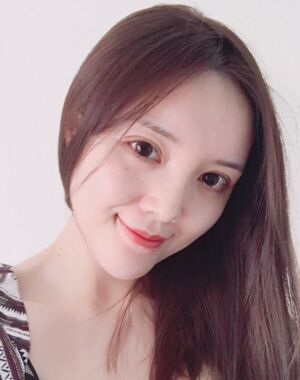 全切雙眼皮+硅膠墊下巴真實(shí)案例對(duì)比圖