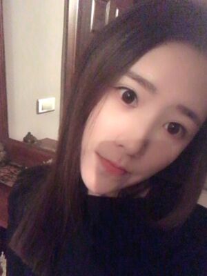 自體脂肪詳細(xì)部填充日記，恢復(fù)過程分享