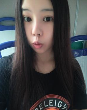 鼻部綜合整形恢復(fù)過程圖分享