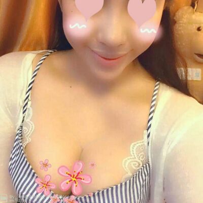 自體脂肪豐胸對(duì)比照片，福州愛(ài)美爾張勝利做的