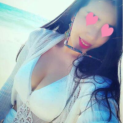 自體脂肪豐胸對(duì)比照片，福州愛(ài)美爾張勝利做的