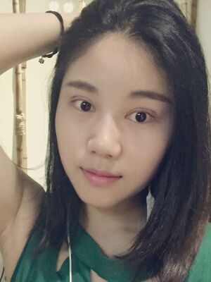 福州愛美爾切開雙眼皮消腫過程圖分享