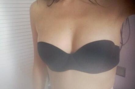 自體脂肪移植隆胸果圖分享，吸脂隆胸價格18800元