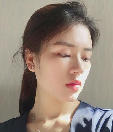 廣州凱美達(dá)皮膚美容激光祛斑前后對比