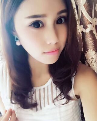 雙眼皮失敗修復(fù)果圖，福州愛美爾王召克做的