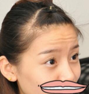 注射瘦臉去抬頭紋果不錯(cuò)——濟(jì)南吉芙美容整形醫(yī)院