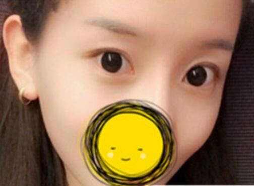 注射瘦臉去抬頭紋果不錯(cuò)——濟(jì)南吉芙美容整形醫(yī)院