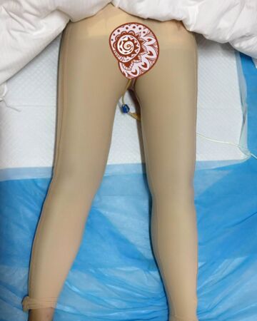 貴陽(yáng)美萊錢剛大腿抽脂親身經(jīng)歷回憶