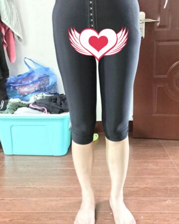 貴陽(yáng)美萊錢剛大腿抽脂親身經(jīng)歷回憶