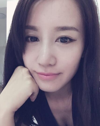 哈爾濱假體隆鼻價格8900元，隆鼻真實案例分享