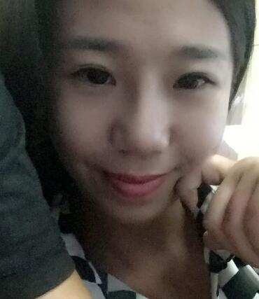 假體隆鼻術(shù)后注意事項(xiàng)和恢復(fù)過程圖分享