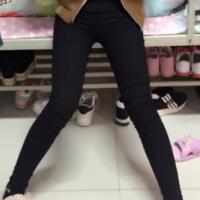 吸脂塑身醫(yī)院推薦歐蘭仁美醫(yī)院，吸脂瘦腿恢復(fù)圖分享