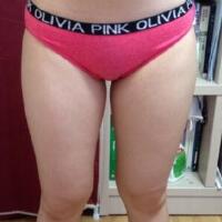 抽脂減肥瘦大腿價格10800元，一個月后恢復(fù)很好