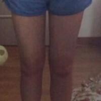 抽脂減肥瘦大腿價格10800元，一個月后恢復(fù)很好