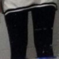 抽脂減肥瘦大腿價格10800元，一個月后恢復(fù)很好