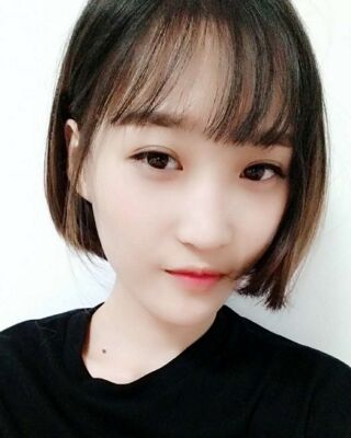 微創(chuàng)全切雙眼皮果對(duì)比照片，貴陽(yáng)麗都葛志鑫手術(shù)案例