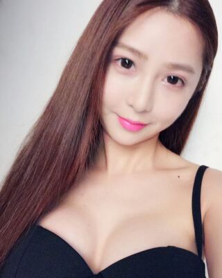 美國(guó)曼托假體隆胸手術(shù)果圖，貴陽(yáng)麗都李觀龍做的