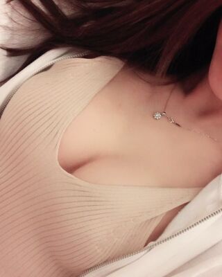 美國(guó)曼托假體隆胸手術(shù)果圖，貴陽(yáng)麗都李觀龍做的