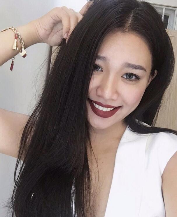 玻尿酸去法令紋前后對(duì)比圖分享