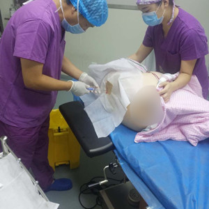 青?？等A馮相周醫(yī)生大腿抽脂案例分享