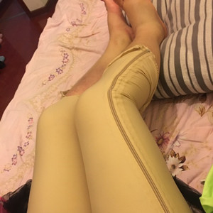 青?？等A馮相周醫(yī)生大腿抽脂案例分享