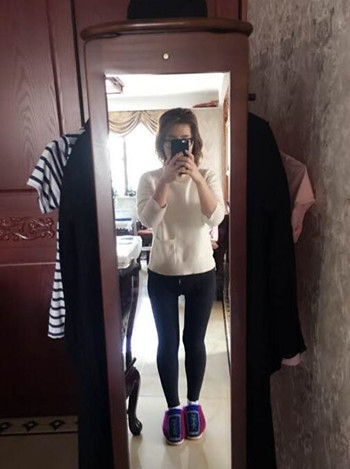 廣州美萊羅延平做的大腿環(huán)吸整形恢復(fù)果過(guò)程案例