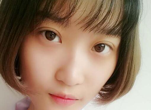 切開雙眼皮多少錢？割雙眼皮真實案例多對比圖分享