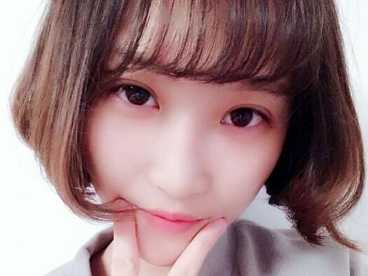 切開雙眼皮多少錢？割雙眼皮真實案例多對比圖分享