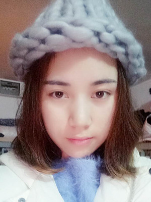 濟(jì)南海峽謝燕燕做的切開雙眼皮，分享前后對(duì)比照片以及恢復(fù)過(guò)程