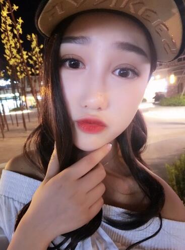 成都蜀尚蓉雅割雙眼皮+開眼角真實(shí)案例