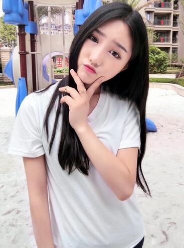 成都蜀尚蓉雅割雙眼皮+開眼角真實(shí)案例