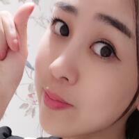 鼻翼縮小手術對比圖分享——四川悅好整形