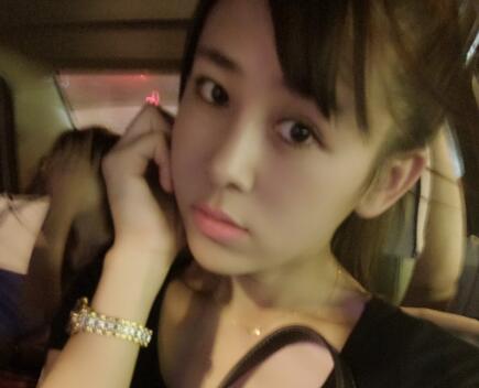 鼻翼縮小手術對比圖分享——四川悅好整形