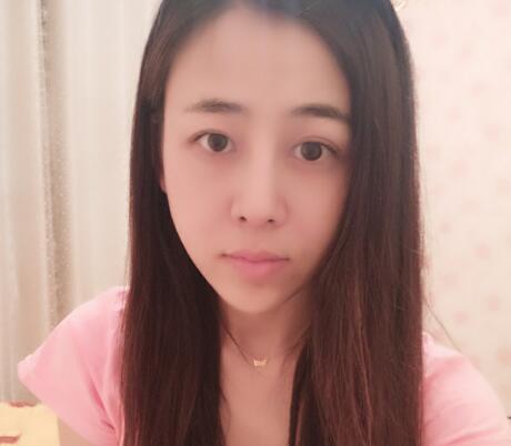 鼻翼縮小手術對比圖分享——四川悅好整形