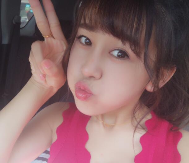 鼻翼縮小手術對比圖分享——四川悅好整形