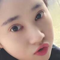 開眼角+割雙眼皮真實案例前后對比圖分享——四川悅好整形