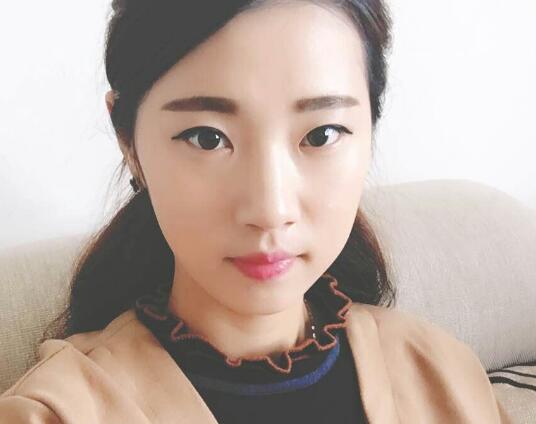 開(kāi)眼角+割雙眼皮真實(shí)案例前后對(duì)比圖分享——四川悅好整形