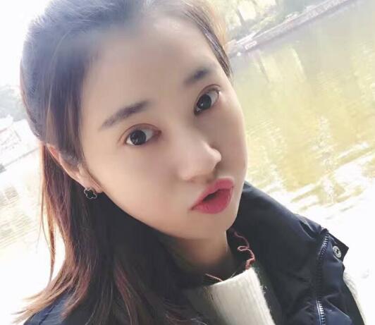 開(kāi)眼角+割雙眼皮真實(shí)案例前后對(duì)比圖分享——四川悅好整形