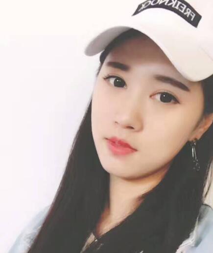 開(kāi)眼角+割雙眼皮真實(shí)案例前后對(duì)比圖分享——四川悅好整形