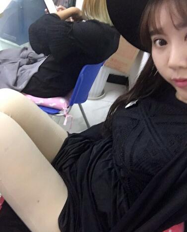 上海九院曹衛(wèi)剛大腿抽脂后恢復圖