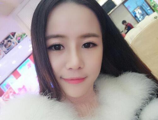 歪鼻子矯正整形恢復(fù)過程和對比圖分享——成都魅麗經(jīng)緯醫(yī)療