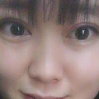 割雙眼皮前后對比圖和恢復(fù)過程——成都魅麗經(jīng)緯整形醫(yī)院