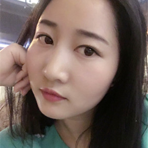 武漢美都張召醫(yī)生做的自體脂肪豐額頭+太陽穴，真實(shí)案例分享