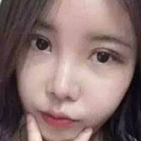 單眼皮變雙眼皮整容日記——廈門安黛美整形醫(yī)院