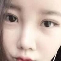 單眼皮變雙眼皮整容日記——廈門安黛美整形醫(yī)院
