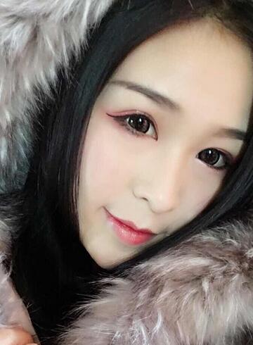 杭州大麥微針龍都整形開眼角+割雙眼皮恢復(fù)記錄