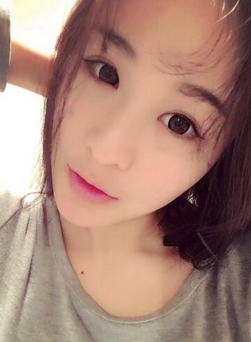 杭州大麥微針龍都整形開眼角+割雙眼皮恢復(fù)記錄